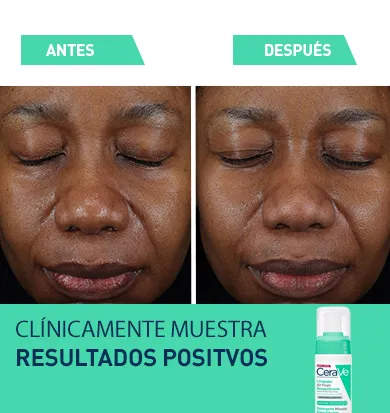 clinically-proven-SM